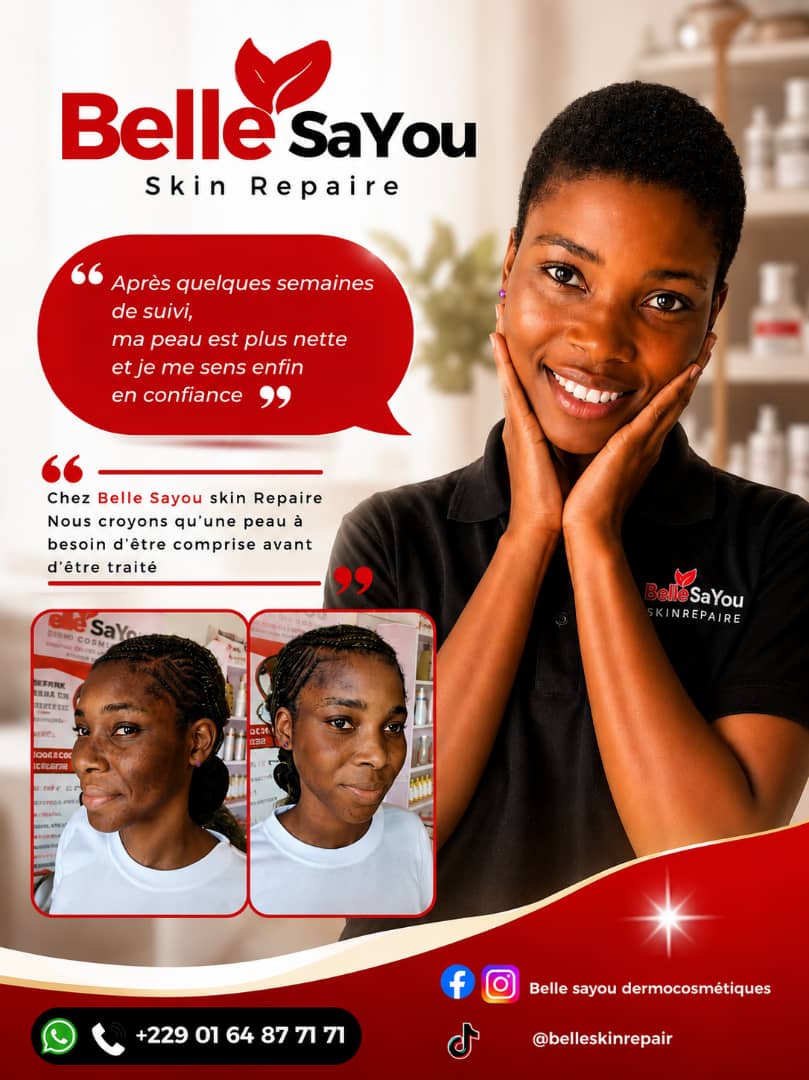 Avant/après employée — peau plus nette